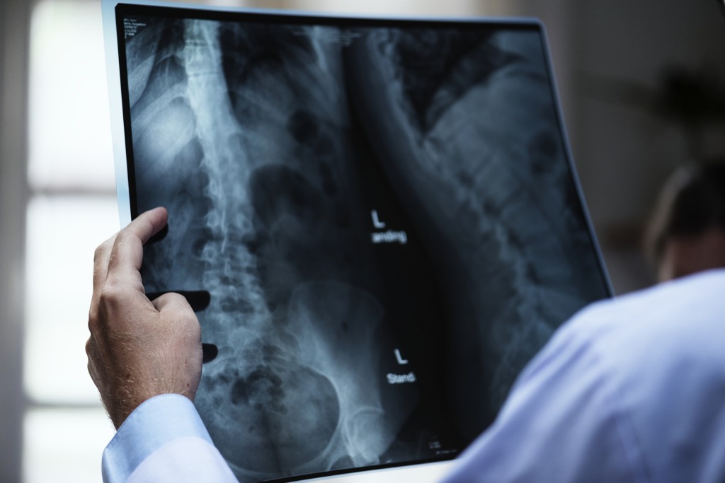 Doctor examining X-ray -Daisy Hill Acute Hospital Newry Imaging Consultation 2018